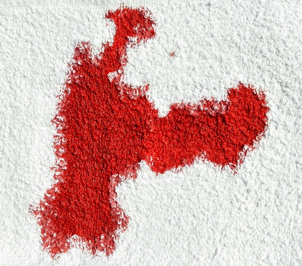Saturation bloodstain on a terry cloth towel